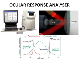 Corneal collagen cross linking | PPTX