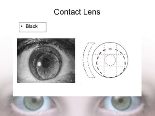 Eye colour coding | PPTX