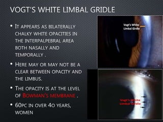 •
•
•
BOWMAN’S MEMBRANE
•
 