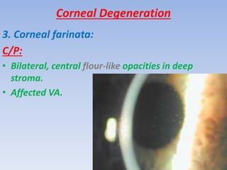 Corneal Degeneration Dystrophies PPTX corneal-degeneration-dystrophies-pptx