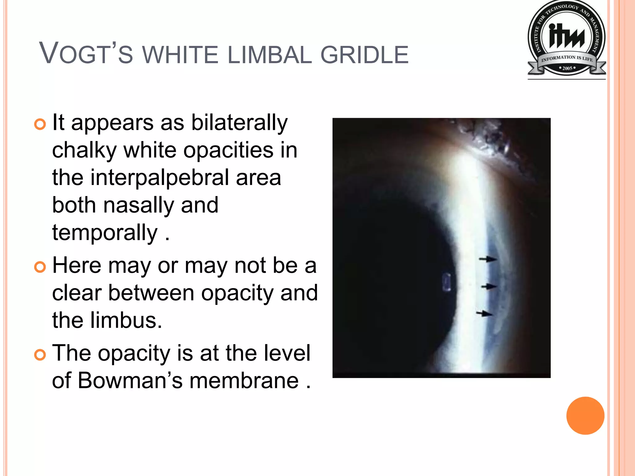 Corneal degeneration ppt | PPTX