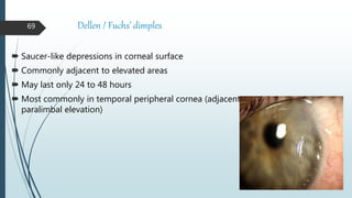 Corneal degeneration | PPTX