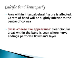  Area within interpalpebral fissure is affected.
Centre of band will be slightly inferior to the
centre of cornea
 Swiss-cheese like appearance: clear circular
areas within the band is seen where nerve
endings perforate Bowman’s layer
 
