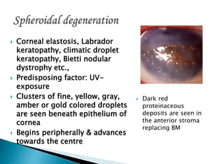 Corneal elastosis, Labrador
keratopathy, climatic droplet
keratopathy, Bietti nodular
dystrophy etc.,
 Predisposing factor: UV-
exposure
 Clusters of fine, yellow, gray,
amber or gold colored droplets
are seen beneath epithelium of
cornea
 Begins peripherally & advances
towards the centre
 Dark red
proteinaceous
deposits are seen in
the anterior stroma
replacing BM
 