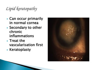  Can occur primarily
in normal cornea
 Secondary to other
chronic
inflammations
 Treat the
vascularisation first
 Keratoplasty
 