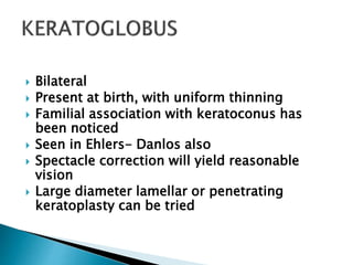  Bilateral
 Present at birth, with uniform thinning
 Familial association with keratoconus has
been noticed
 Seen in Ehlers- Danlos also
 Spectacle correction will yield reasonable
vision
 Large diameter lamellar or penetrating
keratoplasty can be tried
 