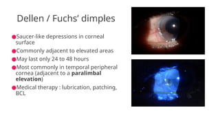 Comprehensive Overview of Corneal Degenerations: Types, Causes, and ...