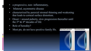 • a progressive, non- inflammatory,
• bilateral, asymmetric disease
• characterized by paraxial stromal thinning and weakening
that leads to corneal surface distortion.
• Onset = around puberty, slow progression thereafter until
the 3rd & 4th decades of life
• Role of heredity?
• Most pts. do not have positive family Hx.
 