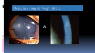 Fleischer ring & Vogt Straie:
&
 