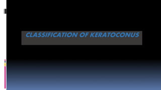CLASSIFICATION OF KERATOCONUS
 