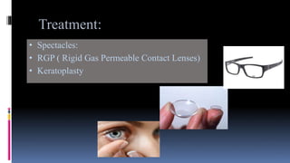 Treatment:
• Spectacles:
• RGP ( Rigid Gas Permeable Contact Lenses)
• Keratoplasty
 