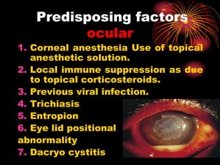 1. Corneal anesthesia Use of topical
anesthetic solution.
2. Local immune suppression as due
to topical corticosteroids.
3. Previous viral infection.
4. Trichiasis
5. Entropion
6. Eye lid positional
abnormality
7. Dacryo cystitis
Predisposing factors
ocular
 