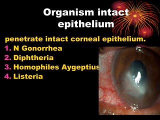 penetrate intact corneal epithelium.
1. N Gonorrhea
2. Diphtheria
3. Homophiles Aygeptius
4. Listeria
Organism intact
epithelium
 