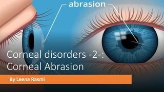 Corneal disorders -2-:
Corneal Abrasion
By Leena Rasmi
 