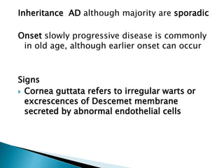 Inheritance AD although majority are sporadic
Onset slowly progressive disease is commonly
in old age, although earlier onset can occur
Signs
 Cornea guttata refers to irregular warts or
excrescences of Descemet membrane
secreted by abnormal endothelial cells
 