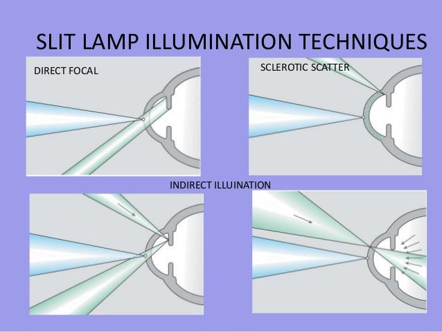 corneal dystrophies 7 638