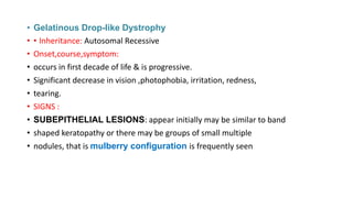 • Gelatinous Drop-like Dystrophy
• • Inheritance: Autosomal Recessive
• Onset,course,symptom:
• occurs in first decade of life & is progressive.
• Significant decrease in vision ,photophobia, irritation, redness,
• tearing.
• SIGNS :
• SUBEPITHELIAL LESIONS: appear initially may be similar to band
• shaped keratopathy or there may be groups of small multiple
• nodules, that is mulberry configuration is frequently seen
 