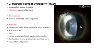 • 2. Macular corneal dystrophy (MCD)
• Known as Fehr spotted dystrophy
• Inheritance: autosomal dominant
• Onset & course :
• occurs in childhood & slowly progressive.
• Symptoms :
• Photophobia & pain, visual impairment, occurs between 10
• & 30 years of age.
• Signs :
• corneal sensitivity reduced,ireggular whitish opacities
• develop letter. Stromal opacities in the central cornea in
• Macular Corneal Dystrophy.
 