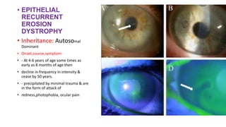 • EPITHELIAL
RECURRENT
EROSION
DYSTROPHY
• Inheritance: Autosomal
Dominant
• Onset,course,symptom:
• - At 4-6 years of age some times as
early as 8 months of age then
• decline in frequency in intensity &
cease by 50 years.
• - precipitated by minimal trauma & are
in the form of attack of
• redness,photophobia, ocular pain
 