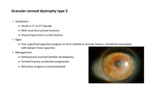 Granular corneal dystrophy type 2
▪ Symptoms:
 Onset in 1st to 2nd decade
 Mild recurrent corneal erosions
 Visual impairment is a late feature
▪ Signs
 Fine superficial opacities progress to form stellate or annular lesions, sometimes associated
with deeper linear opacities
▪ Management:
 femtosecond assisted lamellar keratoplasty
 Corneal trauma accelerates progression
 Refractive surgery is contraindicated
 