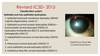 Revised IC3D- 2015
Classification system
◦ Epithelial and Sub-epithelial dystrophies
1. Epithelial basement membrane dystrophy (EBMD)
majority degenerative, rarely C1
2. Epithelial recurrent erosion dystrophies (EREDs)—
Franceschetti corneal dystrophy (FRCD) C3,
Dystrophia Smolandiensis (DS) C3, and Dystrophia
Helsinglandica (DH) C3
3. Subepithelial mucinous corneal dystrophy (SMCD)
C4
4. Meesmann corneal dystrophy (MECD) C1
5. Lisch epithelial corneal dystrophy (LECD) C2
6. Gelatinous drop-like corneal dystrophy (GDLD) C1
Gelatinous Drop-like
Corneal Dystrophy
 