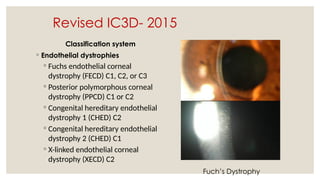 Revised IC3D- 2015
Classification system
◦ Endothelial dystrophies
◦ Fuchs endothelial corneal
dystrophy (FECD) C1, C2, or C3
◦ Posterior polymorphous corneal
dystrophy (PPCD) C1 or C2
◦ Congenital hereditary endothelial
dystrophy 1 (CHED) C2
◦ Congenital hereditary endothelial
dystrophy 2 (CHED) C1
◦ X-linked endothelial corneal
dystrophy (XECD) C2
Fuch’s Dystrophy
 