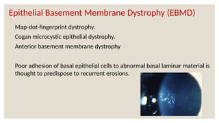 Epithelial Basement Membrane Dystrophy (EBMD)
Map-dot-fingerprint dystrophy.
Cogan microcystic epithelial dystrophy.
Anterior basement membrane dystrophy
Poor adhesion of basal epithelial cells to abnormal basal laminar material is
thought to predispose to recurrent erosions.
 