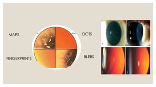 MAPS DOTS
FINGERPRINTS BLEBS
 