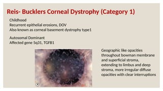 Autosomal Dominant
Affected gene 5q31, TGFB1
Childhood
Recurrent epithelial erosions, DOV
Also known as corneal basement dystrophy type1
Geographic like opacities
throughout bowman membrane
and superficial stroma,
extending to limbus and deep
stroma, more irregular diffuse
opacities with clear interruptions
Reis- Bucklers Corneal Dystrophy (Category 1)
 