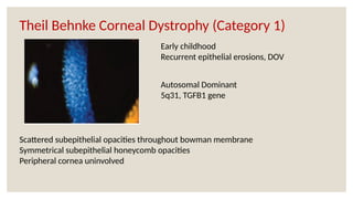 Autosomal Dominant
5q31, TGFB1 gene
Early childhood
Recurrent epithelial erosions, DOV
Scattered subepithelial opacities throughout bowman membrane
Symmetrical subepithelial honeycomb opacities
Peripheral cornea uninvolved
Theil Behnke Corneal Dystrophy (Category 1)
 
