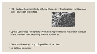◦ HPE- thickened abnormal subepithelial fibrous layer (that replaces the Bowman
layer - sawtooth-like surface
◦ Optical Coherence Tomography- Prominent hyperreflective material at the level
of the Bowman layer extending into the epithelium
◦ Electron Microsopy- curly collagen fibers 9 to 15 nm
◦ No optimal treatment
 