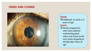 ONSET AND COURSE
Onset
Childhood, as early as 2
years of age.
Course
 Slowly progressive,
with most patients
maintaining good
vision and visual acuity
only rarely dropping to
20/200 after 50yrs of
age.
 