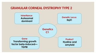 GRANULAR CORNEAL DYSTROPHY TYPE 2
Genetics
C1
Inheritance
Autosomal
dominant
Genetic Locus
5q31
Gene
Transforming growth
factor beta–induced—
TGFBI
Product
Hyaline and
amyloid
 