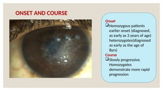 ONSET AND COURSE
Onset
Homozygous patients
earlier onset (diagnosed,
as early as 3 years of age)
heterozygotes(diagnosed
as early as the age of
8yrs)
Course
Slowly progressive.
Homozygotes
demonstrate more rapid
progression
 