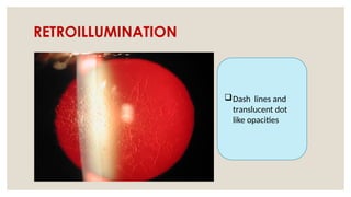 RETROILLUMINATION
Dash lines and
translucent dot
like opacities
 