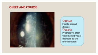 ONSET AND COURSE
Onset
First to second
decade
Course
Progressive, often
with marked visual
decrease by the
fourth decade.
 
