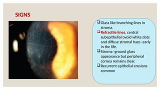 SIGNS
Glass like branching lines in
stroma.
Refractile lines, central
subepithelial ovoid white dots
and diffuse stromal haze -early
in the life.
Stroma -ground glass
appearance but peripheral
cornea remains clear.
Recurrent epithelial erosions
common
 