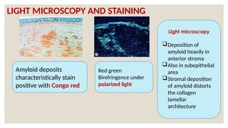 LIGHT MICROSCOPY AND STAINING
Amyloid deposits
characteristically stain
positive with Congo red.
Red green
Birefringence under
polarized light
Light microscopy
Deposition of
amyloid heavily in
anterior stroma
Also in subepithelial
area
Stromal deposition
of amyloid distorts
the collagen
lamellar
architecture
 
