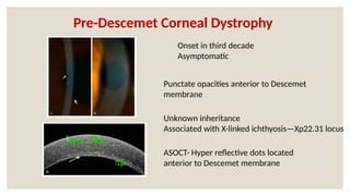 Unknown inheritance
Associated with X-linked ichthyosis—Xp22.31 locus
Onset in third decade
Asymptomatic
Punctate opacities anterior to Descemet
membrane
ASOCT- Hyper reflective dots located
anterior to Descemet membrane
Pre-Descemet Corneal Dystrophy
 