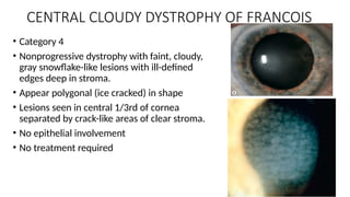 corneal-dystrophy-degeneration-and-treatment-pptx