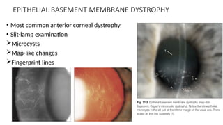 CORNEAL DYSTROPHY, DEGENERATION and treatment | PPTX