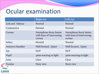 Ocular examination
Right eye Left eye
Lids and Adnexa Normal Normal
Conjunctiva Normal Normal
Cornea Amorphous fuzzy lesion
with haze of intervening
cornea
Amorphous fuzzy lesion
with haze of intervening
cornea
Sclera Normal Normal
Anterior chamber Well formed , Quiet Well formed , Quiet
Iris NCP NCP
Pupil 3mm reacting to light 3mm reacting to light
Lens Clear Clear
Fundus Hazy view Hazy view
 