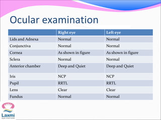 Ocular examination
Right eye Left eye
Lids and Adnexa Normal Normal
Conjunctiva Normal Normal
Cornea As shown in figure As shown in figure
Sclera Normal Normal
Anterior chamber Deep and Quiet Deep and Quiet
Iris NCP NCP
Pupil RRTL RRTL
Lens Clear Clear
Fundus Normal Normal
 