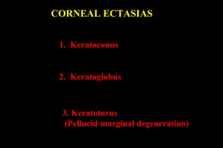 CORNEAL ECTASIAS
1. Keratoconus

2. Keratoglobus

3. Keratotorus
(Pellucid marginal degeneration)

 