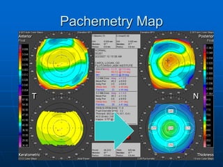 Pachemetry Map