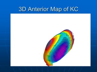 3D Anterior Map of KC