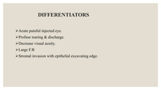 DIFFERENTIATORS
Acute painful injected eye.
Profuse tearing & discharge.
Decrease visual acuity.
Large F.B
Stromal invasion with epithelial excavating edge.
 