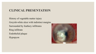 CLINICAL PRESENTATION
History of vegetable matter injury
Greyish-white ulcer with indistinct margins
Surrounded by feathery infiltrates
Ring infiltrate
Endothelial plaque
Hypopyon
 