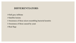 DIFFERENTIATORS
Dull grey infiltrate
Satellite lesions
Awareness of those ulcers resembling bacterial keratitis
Awareness of those caused by yeast
Real flags
 