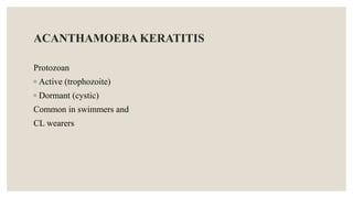 ACANTHAMOEBA KERATITIS
Protozoan
◦ Active (trophozoite)
◦ Dormant (cystic)
Common in swimmers and
CL wearers
 